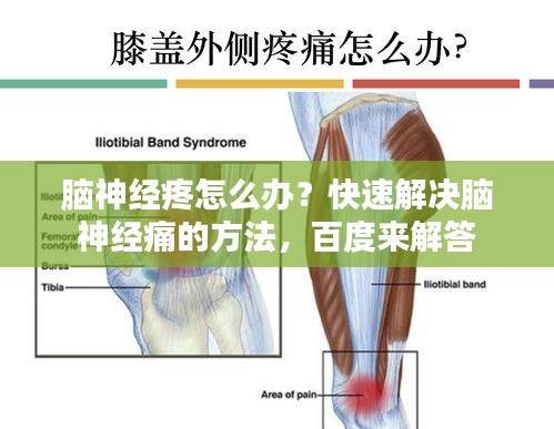 脑神经疼怎么办？快速解决脑神经痛的方法，百度来解答