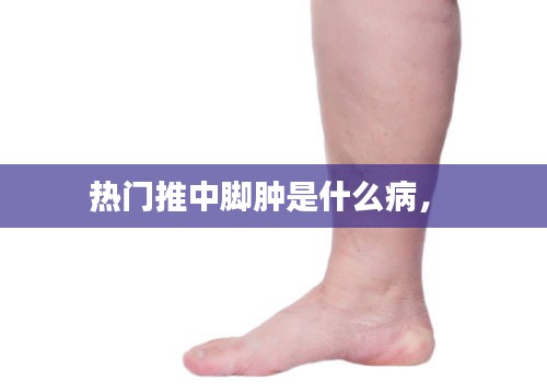 热门推中脚肿是什么病， 